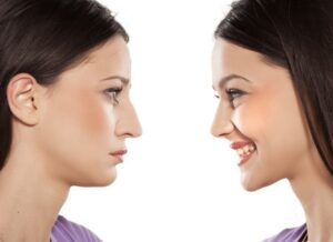 تجميل الانف في الاردن